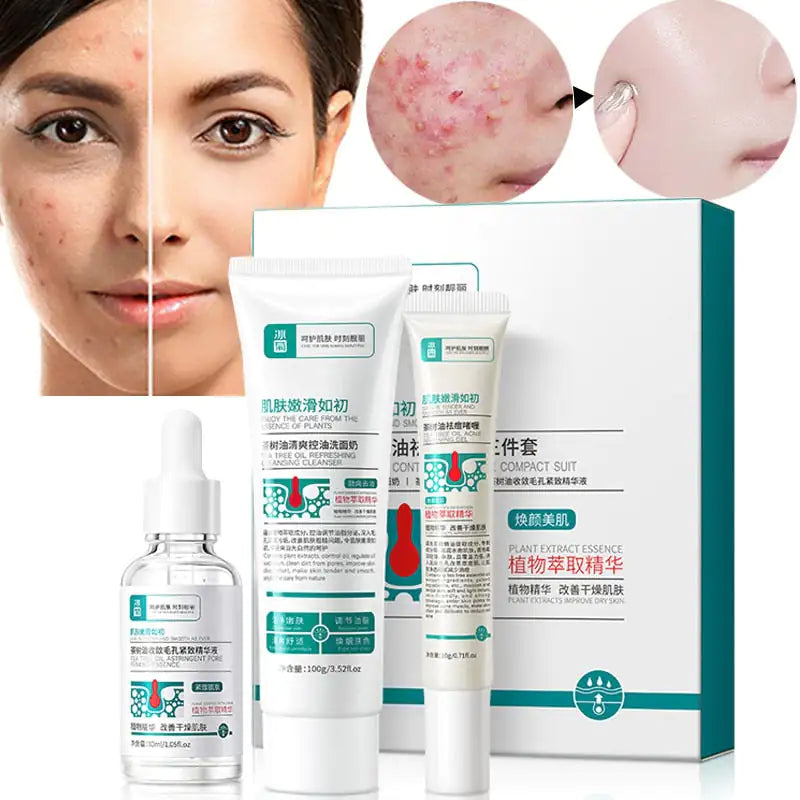 Clear Skin Acne Care Set